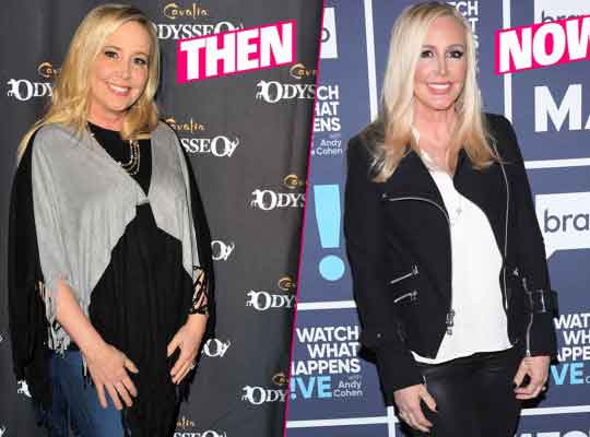 shannon-beador-weight-loss